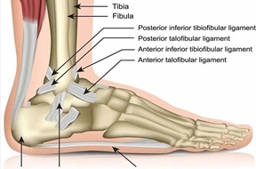 Ankle sprain