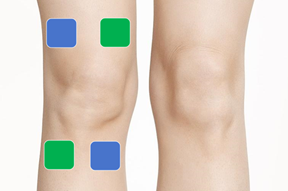 Electrotherapy for OA(Osteoarthritis)