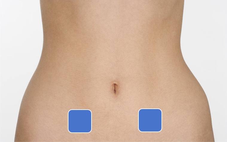 Treatment of dysmenorrhea with electrotherapy equipment