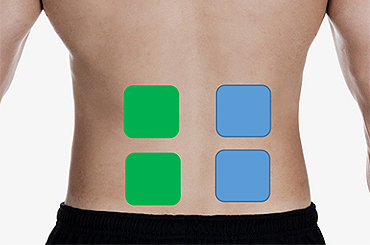 Low Back Pain