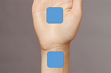 Carpal Tunnel Syndrome